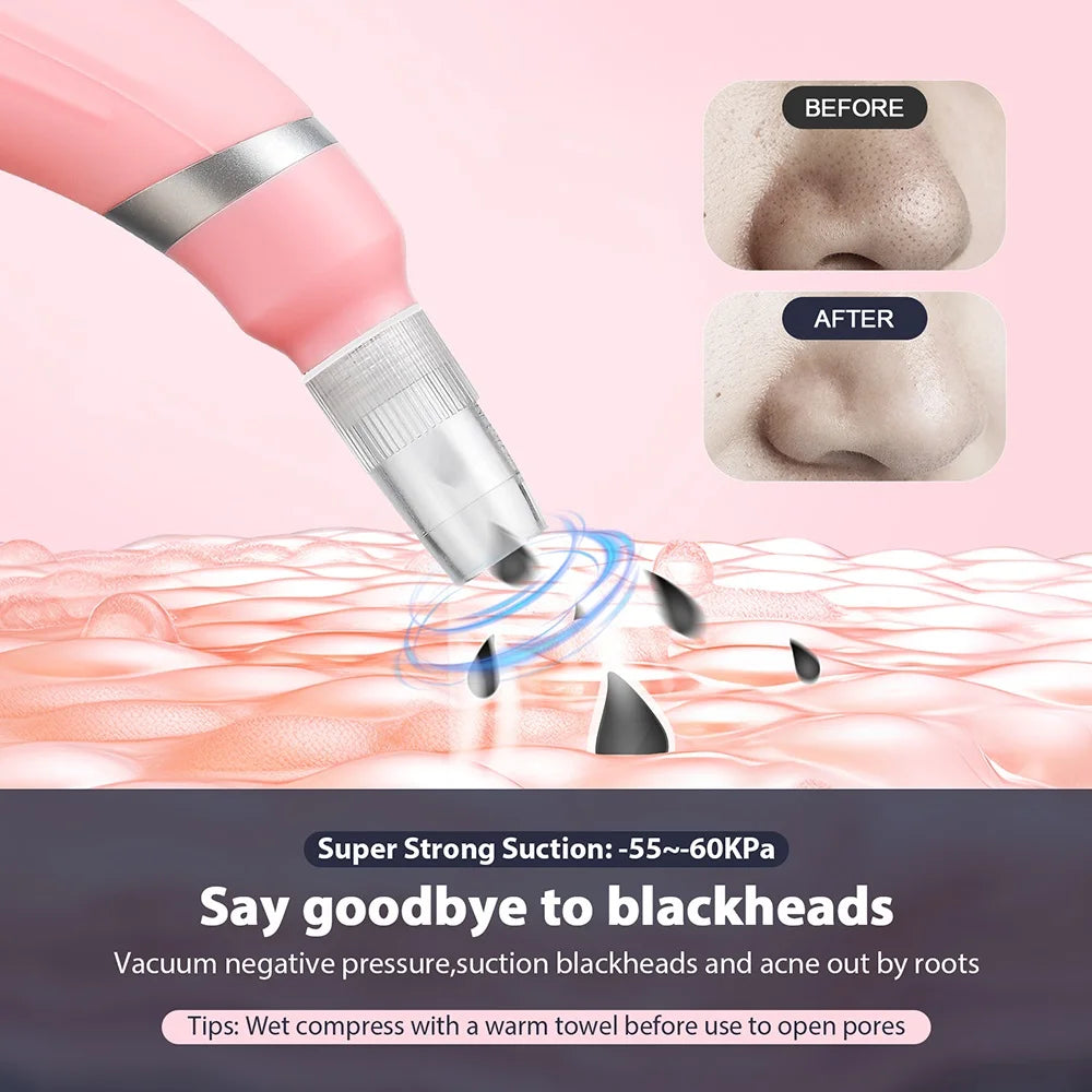 2-In-1 Diamond Microdermabrasion Dermabrasion Machine Water Spray Exfoliation Beauty Machine Facial Peeling Device